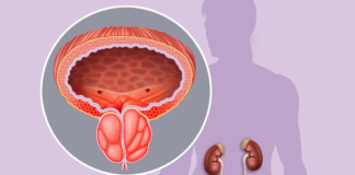 Ciproxin 500: Τι επιδράσεις έχει στη χρόνια προστατίτιδα; Μπορώ να το πάρω χωρίς να με δει Ανδρολόγος;